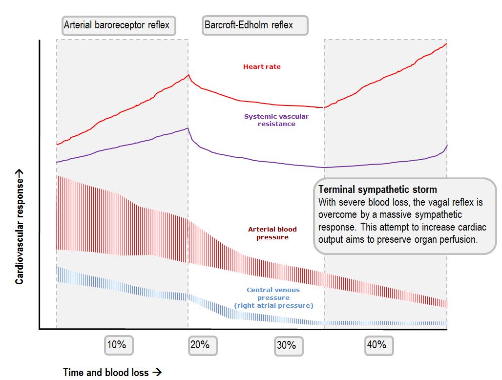 Response to haemorrhage the loss of 1L of blood Deranged Physiology